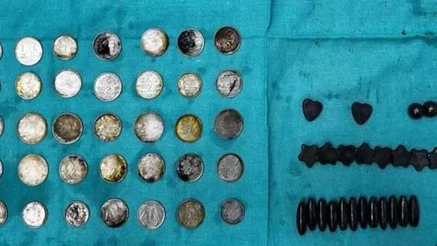 Surgeons find 39 coins and 37 magnets inside man’s intestine because he wanted bigger muscles