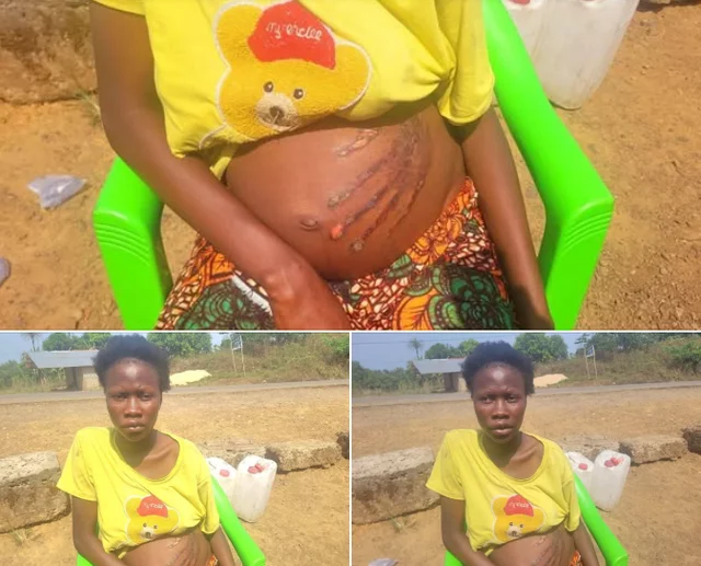 VIDEO: Pregnant woman find bloody handprint on her belly after allegedly slapping a ‘spirit’ in her dream