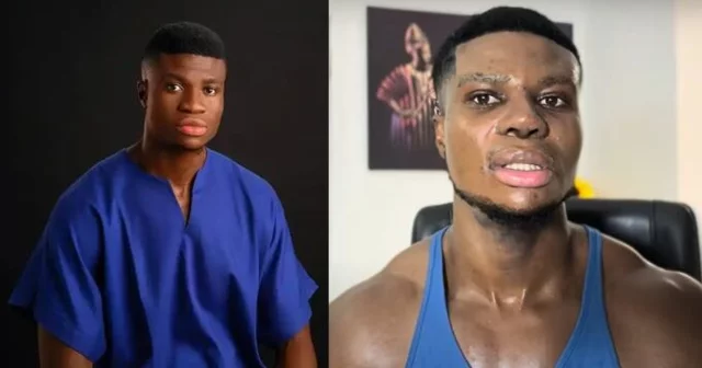 VIDEO: Skit maker ZicsAloma finally shares full details of his Nose Surgery