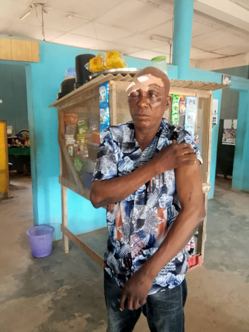 Pandemonium in Oyo as thugs attack ex-Deputy Gov’s residence, others